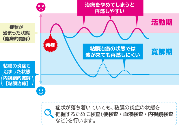 症状が落ち着いていても、粘膜の炎症の状態を把握するために検査（便検査・血液検査・内視鏡検査など）を行います。