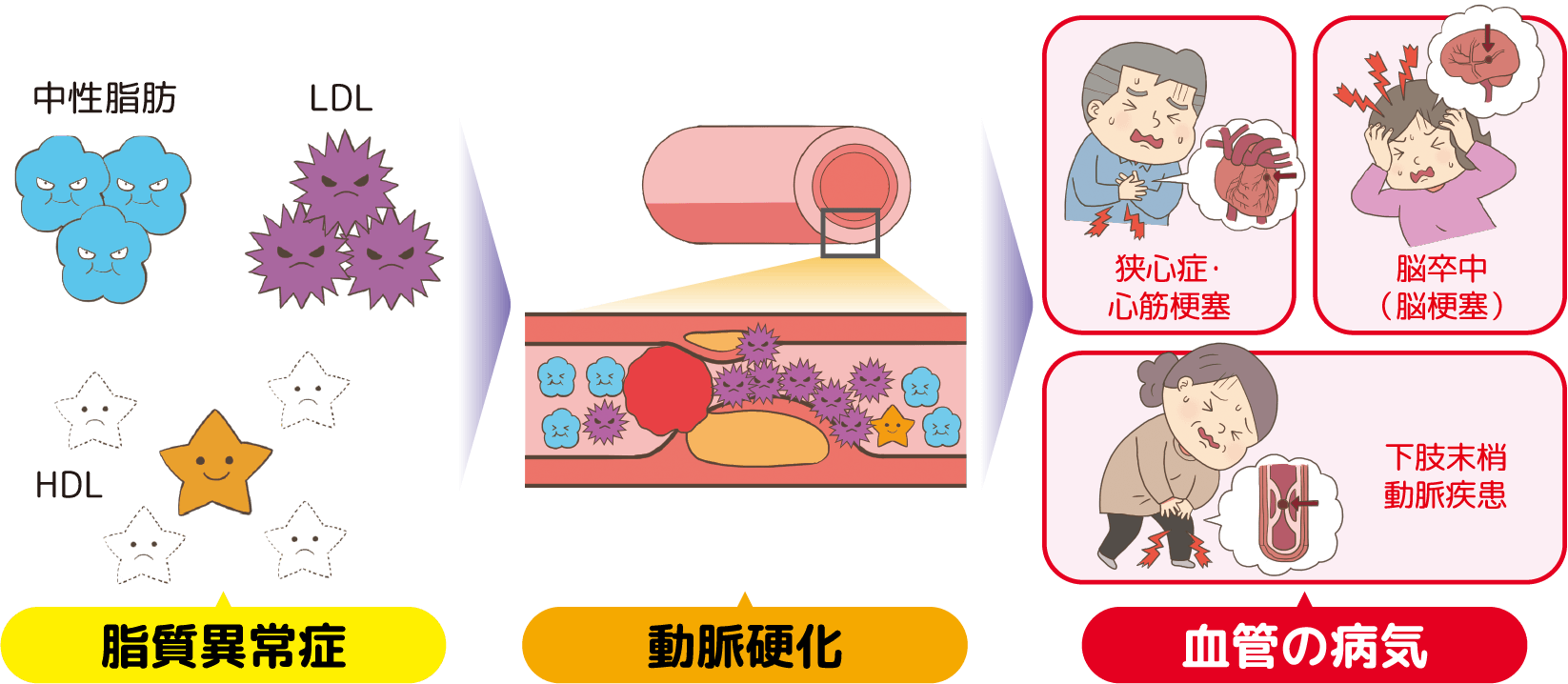 脂質異常症を放っておくと