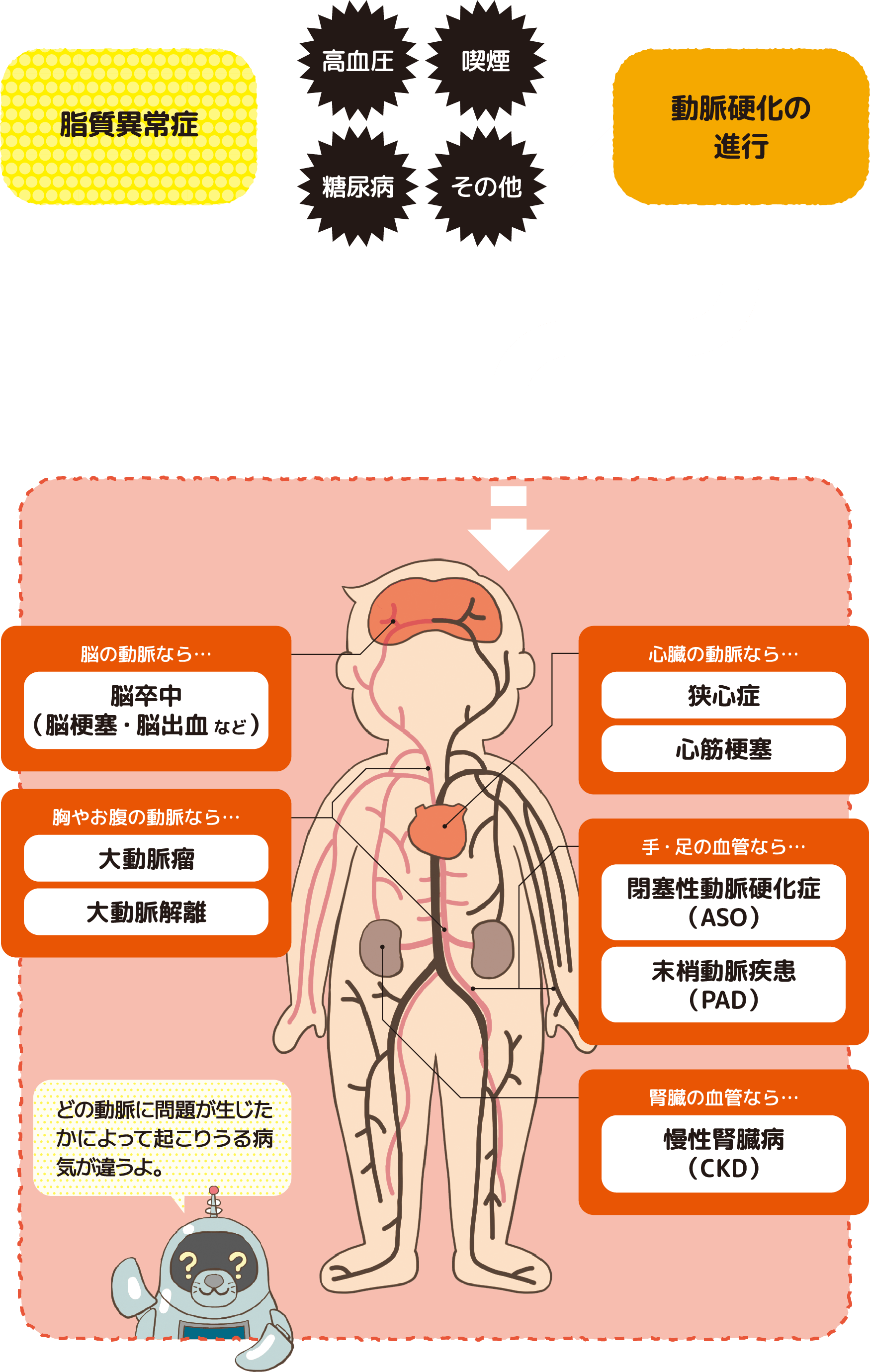 無症状でも要注意