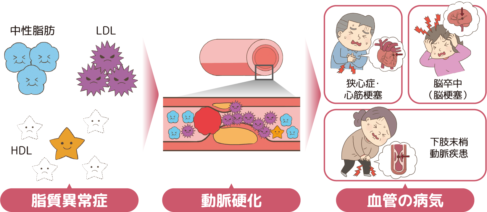 脂質異常症を放っておくと