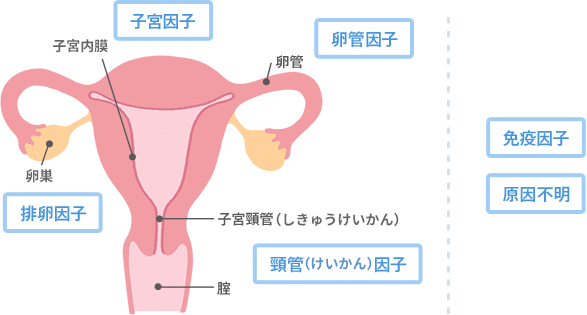 女性側の原因