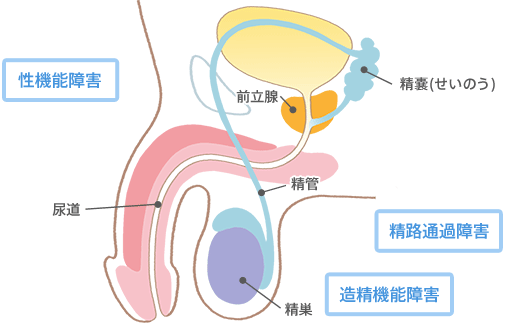 男性側の原因