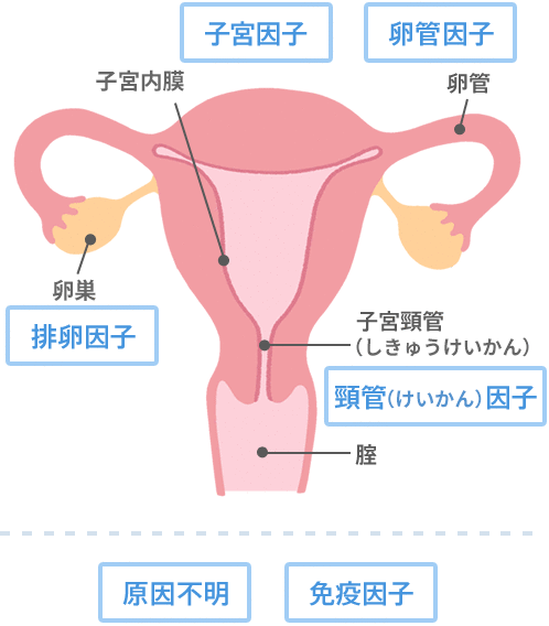 女性側の原因