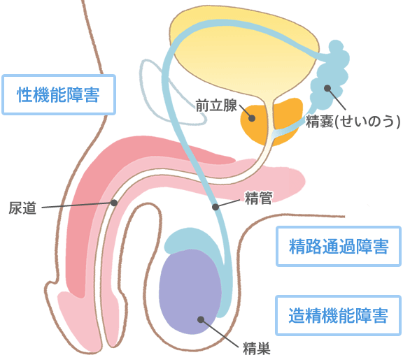 男性側の原因