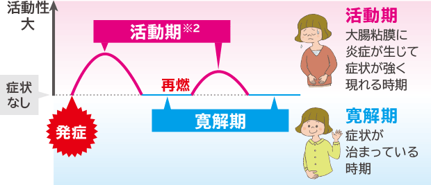 潰瘍性大腸炎の経過