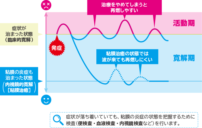 症状が落ち着いていても、粘膜の炎症の状態を把握するために検査（便検査・血液検査・内視鏡検査など）を行います。