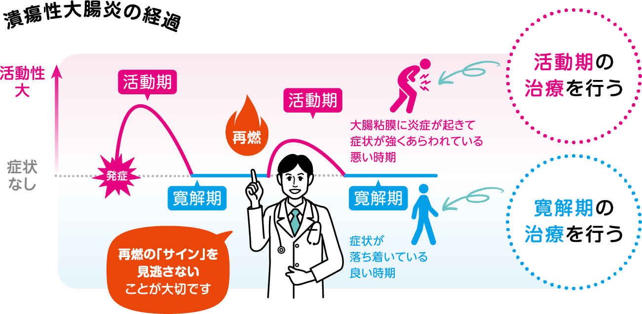 潰瘍性大腸炎の経過