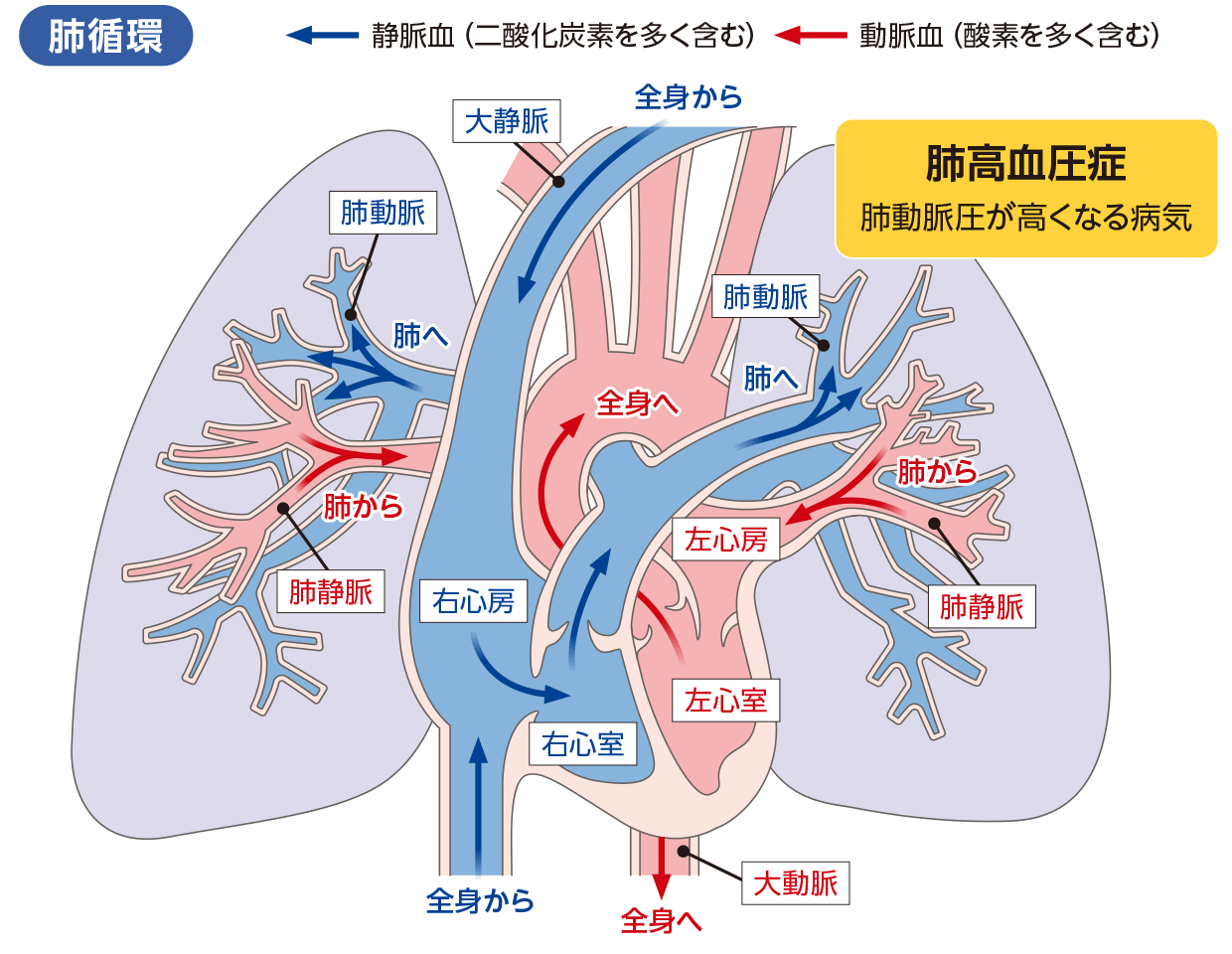 高血圧症で避けるべき運動
