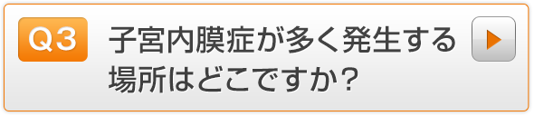 Q3.子宮内膜症が多く発生する場所はどこですか？