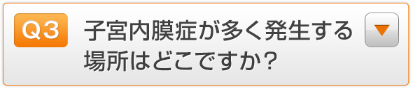 Q3.子宮内膜症が多く発生する場所はどこですか？