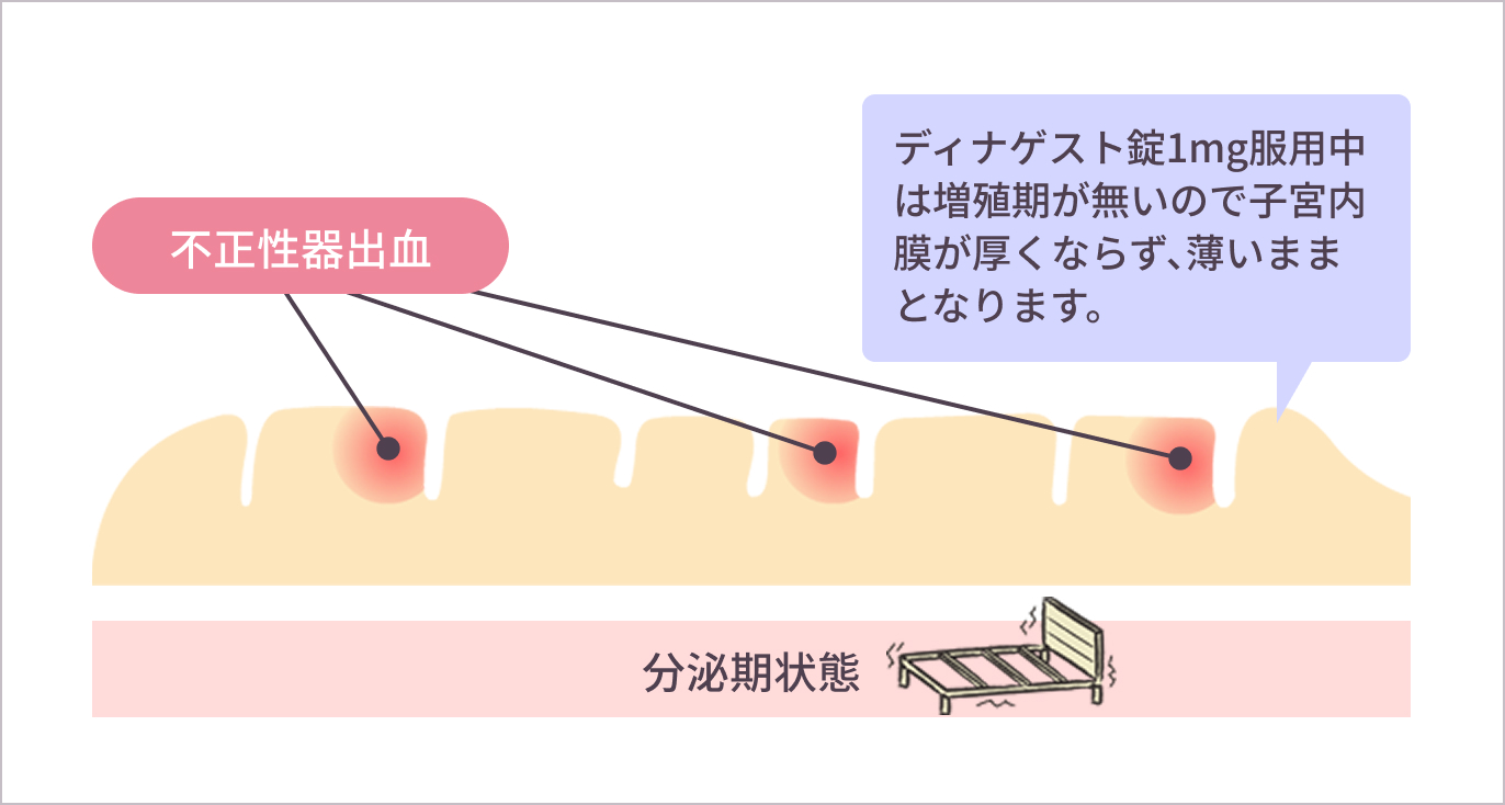薄くなった子宮内膜