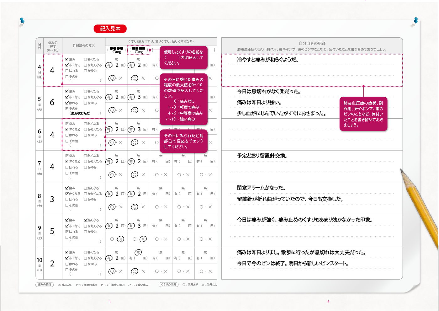 トレプロスト持続皮下投与療法を行う患者さんのための“痛みの管理日誌”